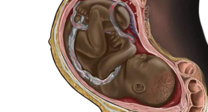 En représentant un fœtus noir, un étudiant révèle l’invisibilisation de la diversité en médecine