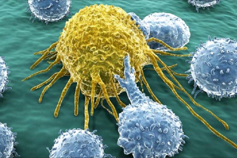 RECHERCHE MÉDICALE : Une avancée révolutionnaire dans le traitement du cancer du pancréas